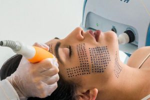 Ultra foccus facial