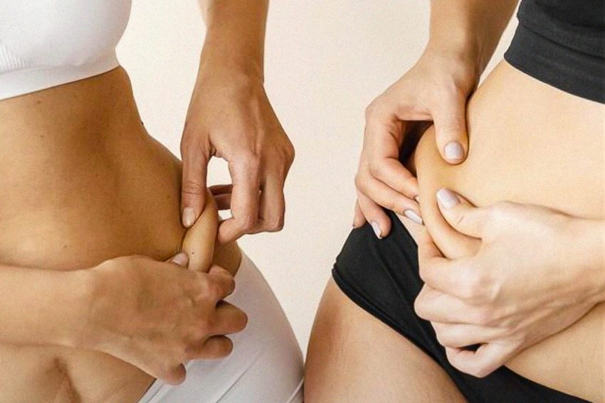 Abdominoplastia: conheça os 3 tipos mais comuns