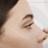 Rinoplastia: a cirurgia no nariz deixa cicatriz?