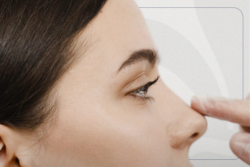 Rinoplastia: a cirurgia no nariz deixa cicatriz?