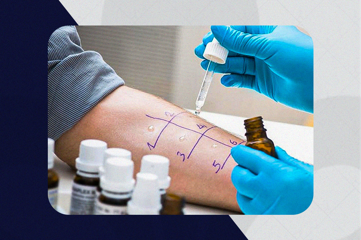 Teste alérgico pré-operatório: quando é indicado